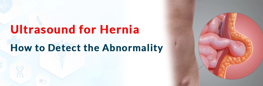  Ultrasound for Hernia, How to Detect the Abnormality